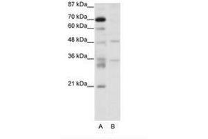 Image no. 1 for anti-Forkhead Box N2 (FOXN2) (C-Term) antibody (ABIN307420)
