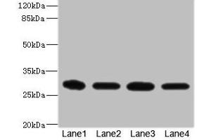 Western blot All lanes: EIF3K antibody at 1. (EIF3K anticorps  (AA 1-218))