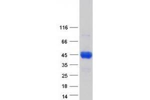Validation with Western Blot (C4BPB Protein (Transcript Variant 1) (Myc-DYKDDDDK Tag))