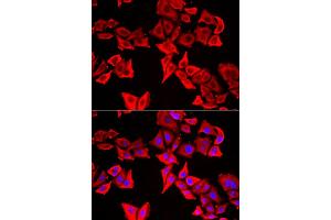 Immunofluorescence analysis of U20S cell using THRSP antibody. (THRSP anticorps)