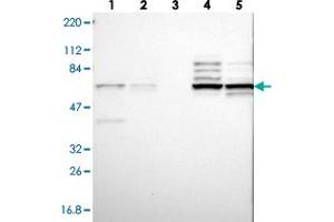 Western blot analysis of Lane 1: RT-4, Lane 2: U-251 MG, Lane 3: Human Plasma, Lane 4: Liver, Lane 5: Tonsil with CNOT4 polyclonal antibody . (CNOT4 anticorps)