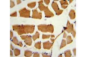 IHC analysis of FFPE human skeletal muscle stained with BMI1 antibody