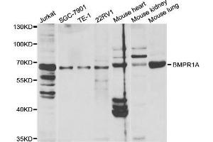 Western blot analysis of extracts of various cell lines, using BMPR1A antibody. (BMPR1A anticorps  (AA 24-200))