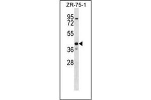 Western blot analysis of KCNK1 Antibody (C-term) in ZR-75-1 cell line lysates (35ug/lane).