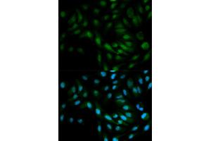 Immunofluorescence analysis of MCF-7 cells using MAPK7 antibody. (MAPK7 anticorps)