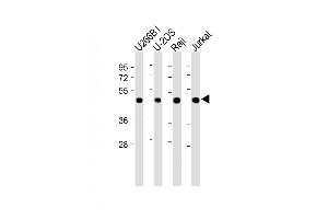 All lanes : Anti-ETV6 Antibody (N-term) at 1:2000 dilution Lane 1: U266B1 whole cell lysate Lane 2: U-2OS whole cell lysate Lane 3: Raji whole cell lysate Lane 4: Jurkat whole cell lysate Lysates/proteins at 20 μg per lane.