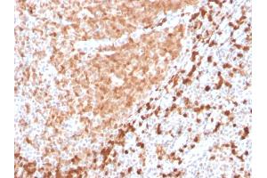 Formalin-fixed, paraffin-embedded human Tonsil stained with TCL1 Recombinant Rabbit Monoclonal Antibody (TCL1/2747R).