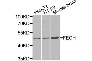 Western blot analysis of extracts of various cells, using FECH antibody. (FECH anticorps)