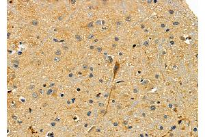 ABIN6265196 and ABIN6277869 at 1/100 staining Rat brain tissue by IHC-P. (SMURF2 anticorps  (Internal Region))