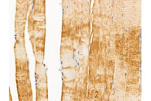 ABIN6260460 and ABIN6266503 at 1/100 staining Rat muscle tissue by IHC-P.