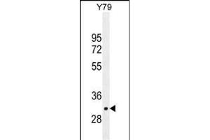 LRRC46 Antibody (N-term) (ABIN655306 and ABIN2844888) western blot analysis in Y79 cell line lysates (35 μg/lane). (LRRC46 anticorps  (N-Term))