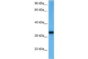 Host:  Mouse  Target Name:  SOX12  Sample Tissue:  Mouse Liver  Antibody Dilution:  1ug/ml