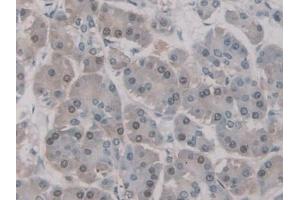 Detection of UNG in Human Pancreas Tissue using Polyclonal Antibody to Uracil DNA Glycosylase (UNG)