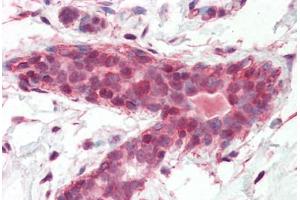 anti-BRCA1 Associated Protein (BRAP) (AA 67-79) antibody