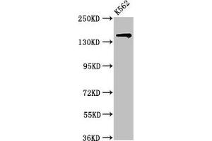 Western Blot Positive WB detected in: K562 whole cell lysate All lanes: SIN3A antibody at 2 μg/mL Secondary Goat polyclonal to rabbit IgG at 1/50000 dilution Predicted band size: 146 kDa Observed band size: 146 kDa