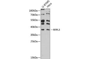 Western blot analysis of extracts of various cell lines, using RFPL3 antibody (ABIN6130677, ABIN6146893, ABIN6146894 and ABIN6215966) at 1:3000 dilution. (RFPL3 anticorps  (AA 1-288))