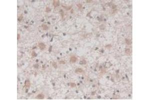 Detection of TMEM27 in Human Glioma Tissue using Monoclonal Antibody to Transmembrane Protein 27 (TMEM27)