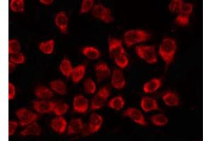 ABIN6266601 staining K562 by IF/ICC. (NME2 anticorps  (Internal Region))