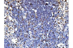 IHC analysis of PAK1 using anti-PAK1 antibody (ABIN7599852).