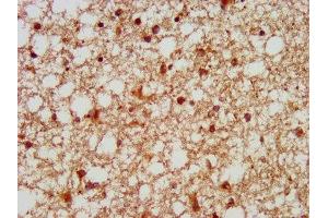 IHC image of ABIN7153781 diluted at 1:100 and staining in paraffin-embedded human brain tissue performed on a Leica BondTM system. (GTF3C5 anticorps  (AA 305-448))