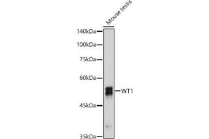 Western blot analysis of extracts of Mouse testis, using WT1 antibody  at 1:1000 dilution. (WT1 anticorps)