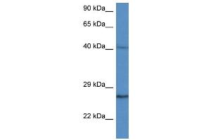 WB Suggested Anti-CCS AntibodyTitration: 1. (Superoxide dismutase copper chaperone anticorps  (C-Term))