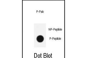 Dot blot analysis of anti-Phospho-KLF4- Antibody (ABIN390035 and ABIN2839785) on nitrocellulose membrane. (KLF4 anticorps  (pSer254))