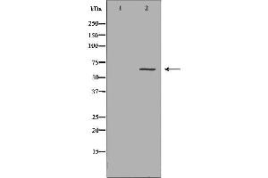 Western blot analysis of Hepg2 whole cell lysates, using CES1 Antibody. (CES1 anticorps  (C-Term))