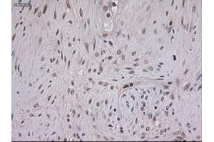 Immunohistochemical staining of paraffin-embedded kidney using anti-STAT3 (ABIN2452542) mouse monoclonal antibody. (STAT3 anticorps  (AA 154-175))