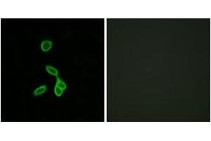Immunofluorescence analysis of LOVO cells, using GALR1 Antibody. (Galanin Receptor 1 anticorps  (AA 161-210))