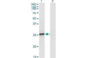 Western Blot analysis of AMELX expression in transfected 293T cell line by AMELX monoclonal antibody (M02A), clone 5B2. (AMELX anticorps  (AA 93-191))
