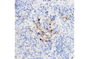 Immunohistochemistry of paraffin-embedded rat spleen using YKL-40/CHI3L1 antibody (ABIN3022444, ABIN3022445, ABIN3022446 and ABIN6218823) at dilution of 1:100 (40x lens).