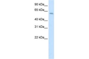 Western Blotting (WB) image for anti-Apoptosis Antagonizing Transcription Factor (AATF) antibody (ABIN2461824)