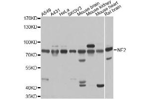 Western blot analysis of extracts of various cell lines, using NF2 antibody. (Merlin anticorps)