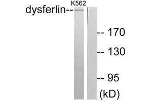 Western blot analysis of extracts from K562 cells, using Dysferlin antibody. (Dysferlin anticorps)