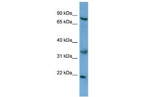 WB Suggested Anti-ABCD2 Antibody Titration: 0. (CCL17 anticorps  (N-Term))