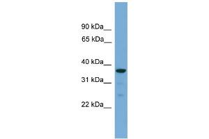 WB Suggested Anti-HAPLN2 Antibody Titration: 0. (HAPLN2 anticorps  (Middle Region))