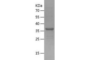 Western Blotting (WB) image for Ubiquitin-Conjugating Enzyme E2D 1 (UBE2D1) (AA 1-147) protein (His-IF2DI Tag) (ABIN7125608) (UBE2D1 Protein (AA 1-147) (His-IF2DI Tag))