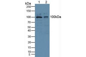 Western blot analysis of (1) Human HeLa cells and (2) Human PC-3 Cells. (PLA2G4A anticorps  (AA 563-749))