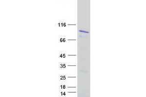 Validation with Western Blot
