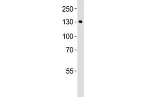 Western blot analysis of lysate from mouse bladder tissue lysate using MLCK antibody diluted at 1:1000. (MYLK anticorps  (AA 908-938))