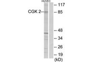 Western blot analysis of extracts from HuvEc cells, using CGK 2 Antibody. (PRKG2 anticorps  (AA 391-440))