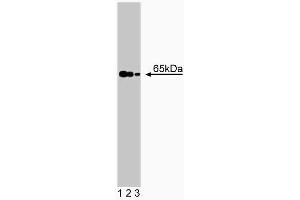 Western blot analysis of NMT-2 on human endothelial lysate.