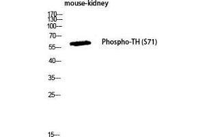Western Blot (WB) analysis of Mouse Kidney lysis using Phospho-TH (S71) antibody. (TH anticorps  (pSer71))