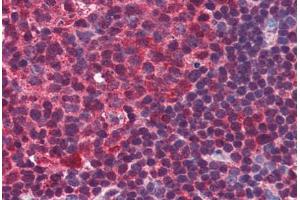 anti-PR Domain Containing 1, with ZNF Domain (PRDM1) (C-Term) antibody