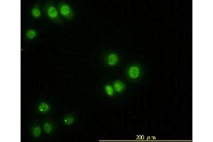 Immunofluorescence of monoclonal antibody to STK38 on HeLa cell.