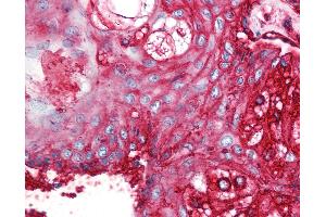 Anti-CD59 antibody IHC of human skin, pilosebaceous unit. (CD59 anticorps)