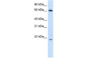 WB Suggested Anti-NIP7 Antibody Titration:  0.