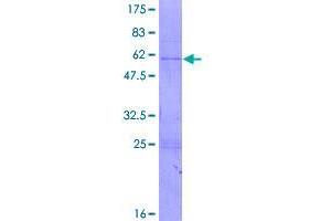 Image no. 1 for Ribonuclease H1 (RNASEH1) (AA 1-286) protein (GST tag) (ABIN1318158)