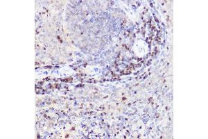 Immunohistochemistry of paraffin-embedded rat spleen using CTIP2/BCL11B Rabbit pAb (ABIN7265808) at dilution of 1:50 (40x lens).